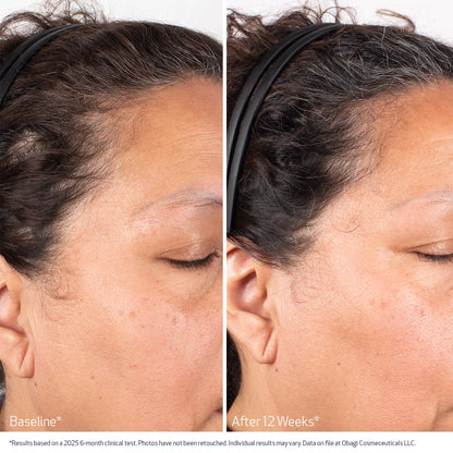 Elevair™ Advanced Hair Growth Roll-On Serum