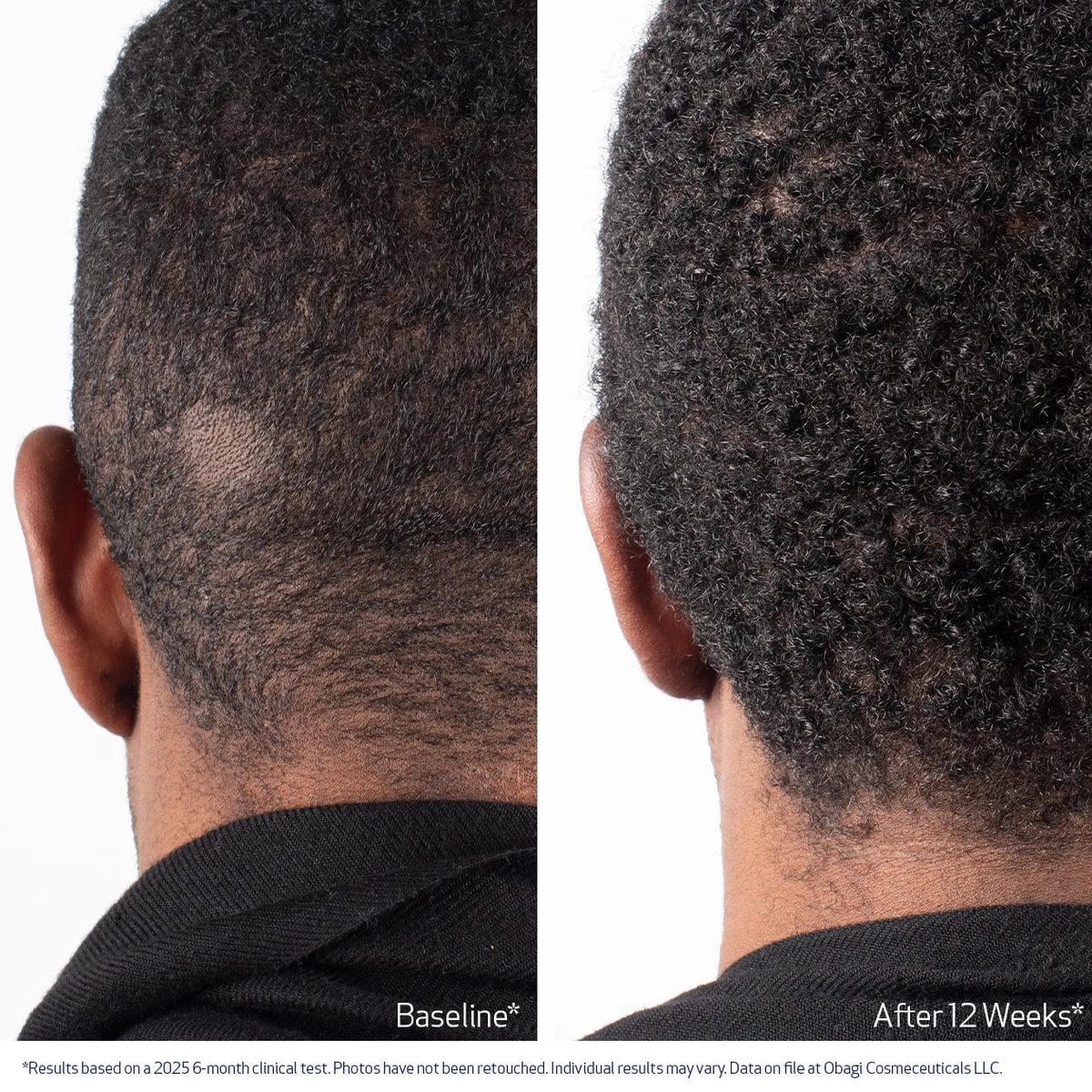 Elevair™ Advanced Hair Growth Roll-On Serum