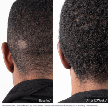 Elevair™ Advanced Hair Growth Roll-On Serum
